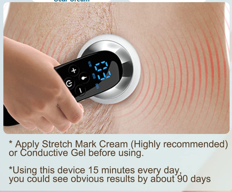 CXGRISE Body Shaping Machine Belly Arm Cellulite Stretch Mark Massager Tightening Device Great Gift